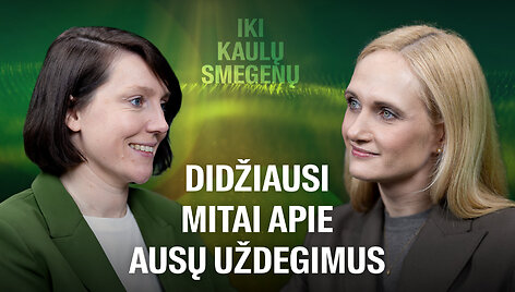 &bdquo;Iki kaulų smegenų&ldquo;