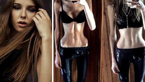 modelis-paula-cepinskaite-atvirai-pasakojo-apie-anoreksijos-pradzia