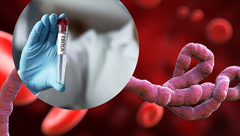 Ebola