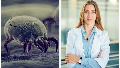 Dulkių erkutės asociatyvi nuotr. ir gyd. alergologė&ndash;klinikinė imunologė Justina Rudytė