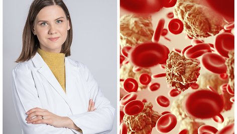 Gyd. hematologė Rūta Semaškevičienė ir asociatyvi nuotr. 