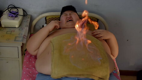 Li Song, Kinija, &scaron;iuolaikinių problemų kategorija &ndash; 2 vieta, serija &bdquo;Noriu gyventi įprastą gyvenimą&ldquo;