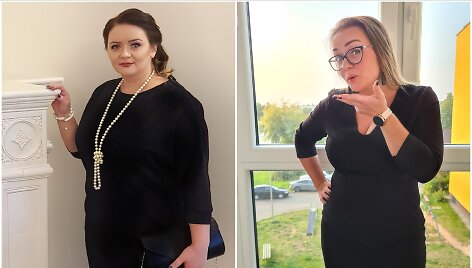 Olgos i&scaron;vaizdos pokyčiai &ndash; prie&scaron; ir po