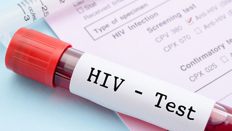 ŽIV testas