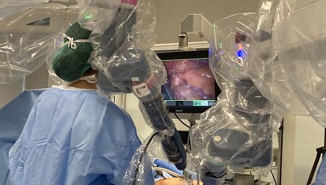 Klaipėdos universiteto ligoninės komanda, jau tapusi inovatoriais robotinės chirurgijos srityje, trečiadienį atliko pirmąją operaciją, kai pasitelktas dirbtinis intelektas.