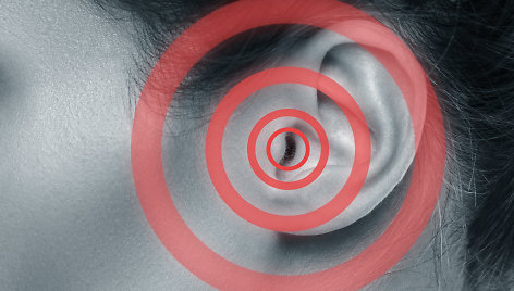 Cypimas ausyse – nemalonus simptomas, su kuriuo susiduria nemaža dalis populiacijos