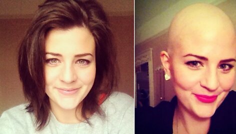 Laura Cannon prie&scaron; chemoterapiją ir po jos