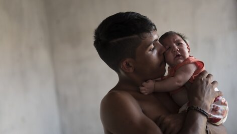 Zika virusu užsikrėtęs kūdikis Brazilijoje