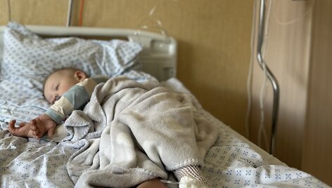1,5 metų Adomas serga akies vėžiu, kuris Lietuvoje negydomas