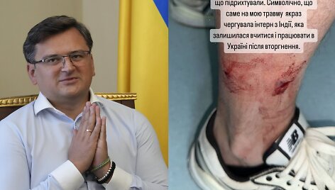 Ukrainos užsienio reikalų ministrą Dmytro Kulebą apkandžiojo &scaron;uo