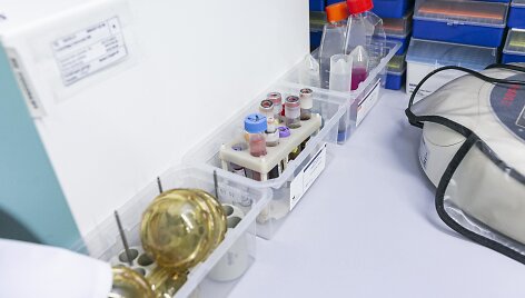 Laboratorijos akimirka