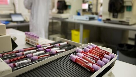 WADA paskelbtos i&scaron;vados neatitinka tikrovės