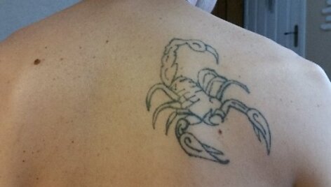 Tatuiruočių &scaron;alinimas lazeriu
