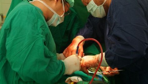 Inkstų transplantacija Santariškėse