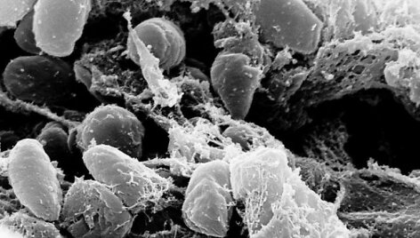 Yersinia pestis bakterija