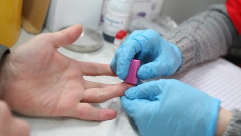 Europos aikštėje siūloma nemokamai pasidaryti greitąjį ŽIV testą.