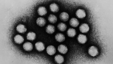 JAV agentūra: mįslingo vaikų hepatito atvejai gali būti susiję su tam tikru adenovirusu