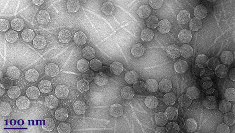 E.coli bakteriją infekuojantis Caldo virales (liet. uodeguotieji virusai) būrio virusas Js20