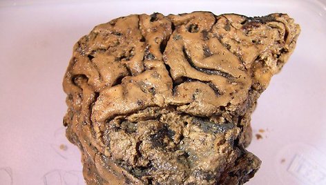 Heslingtono smegenys, išsilaikiusios 2600 metų