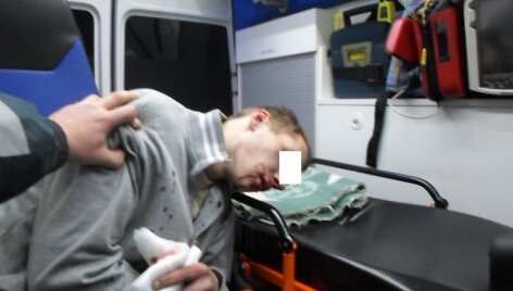 Broliai Drevernoje mu&scaron;ėsi tiek, kol vienas kitam sužalojo galvas.