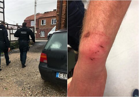 Kaunietis teigia, kad policijos pareigūnai prie&scaron; jį neteisėtai panaudojo jėgą