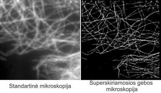 Gražvydo Lukinavičiaus iliustr./Standartinės ir superskiriamosios gebos mikroskopijos galimybių palyginimas