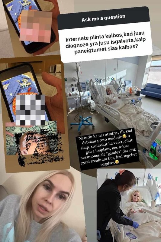 Simona Milinytė sureagavo į kalbas, neva ji suvaidino ligą