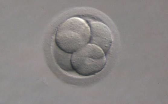 EHSRE Žmogaus embriologijos atlaso nuotr./Embrionas