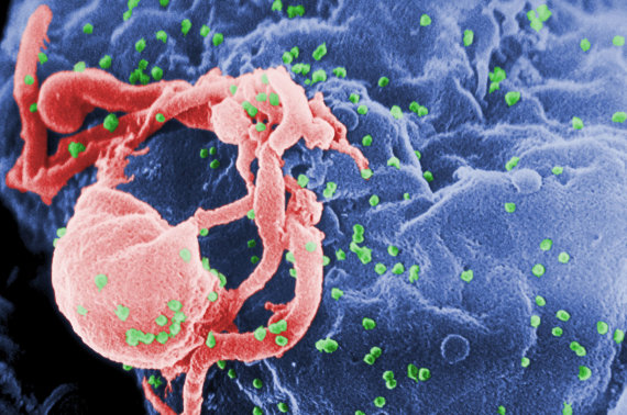 „Scanpix“/AP nuotr./Prie ląstelės paviršiaus prikibęs ŽIV virusas