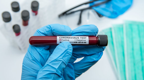 Photo from 123RF.com/Coronavirus testing 