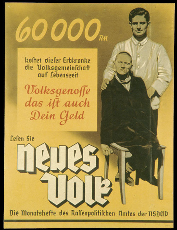 Wikipedia.org nuotr./Nacistinės propagandos pavyzdys: „Šis įgimtų defektų turintis asmuo visuomenei per savo gyvenimą kainuoja 60 000 reichsmarkių. Tautieti, tai taip pat ir tavo pinigai“.