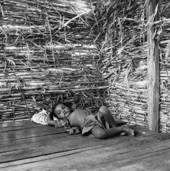 akg-images / Scanpix photo / A child with depression in Colombia