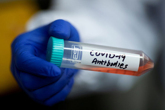 Reuters / Scanpix Photo / Anti-coronavirus antibody solution