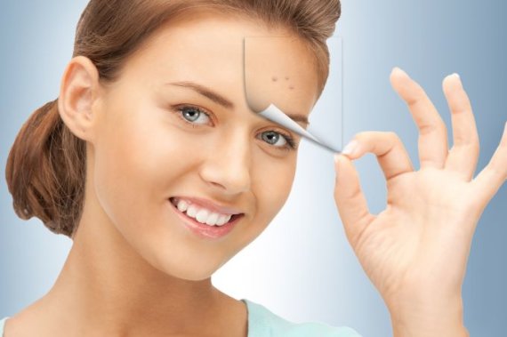 Fotolia photo / How to get rid of acne?