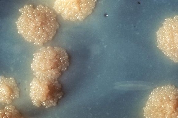 Wikimedia.org nuotr./Tuberkuliozės mikrobakterija