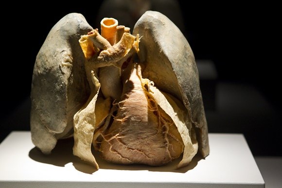 Viganto Ovadnevo nuotr./Parodos „The Human Body Exhibition“ eksponatas