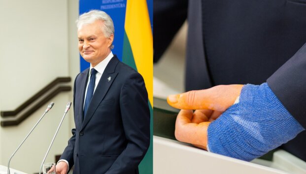 Po Nausėdos dilbio traumos traumatologas įvertino galimas komplikacijas