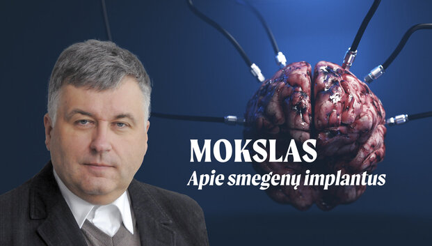Mokslas apie smegenų implantus: ar &scaron;i technologija gali valdyti žmogų ir kada paplis pasaulyje?