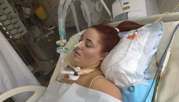 Medikai i&scaron;traukė 2 vaikų mamą i&scaron; mirties: po &bdquo;pakartotinų&ldquo; vėjaraupių &ndash; reanimacija ir mokymasis i&scaron; naujo judėti