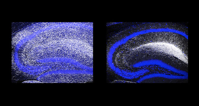 Kolumbijos Zuckermano instituto iliustr./Sveikos pelės (kairėje) ir pelės be Pcdhac2 geno nervų ląstelės
