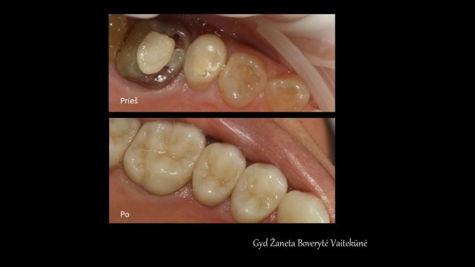 Klinikos „Medwell“ nuotr./Funkcinės odontologijos pavyzdys