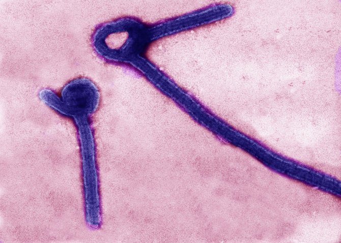 „Reuters“/„Scanpix“ nuotr./Ebolos virusas