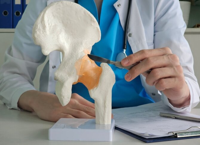 Shutterstock nuotr./Klubo sąnario keitimo operacija