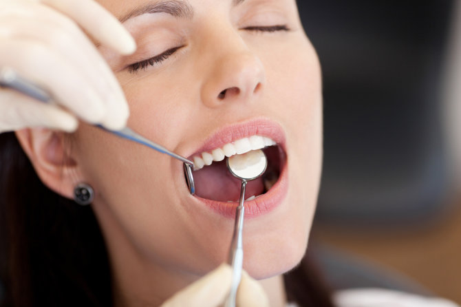 „Shuterstock“ nuotr./Specialios balinančios dantų pastos  gali pašviesinti jūsų dantis, bet jei norite geresnio efekto, kreipkitės į odontologą.
