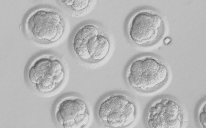 „Reuters“/„Scanpix“ nuotr./Besivystantys žmogaus embrionai, kuriuose panaudota DNR iš odos ląstelių, trečiąją vystymosi dieną. 