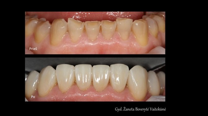 Klinikos „Medwell“ nuotr./Funkcinės odontologijos pavyzdys