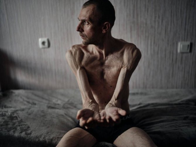 Instagram/Libkos/Rusų nelaisvėje buvę ukrainiečiai neteko po 40 kg svorio