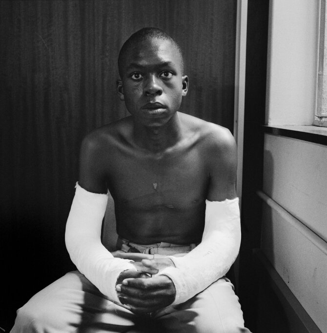 D.Goldblatto palikimo fondo ir Goodman galerijos nuosavybė/David Goldblatt. Penkiolikmetis Lawrence‘as Matjee po to, kai jį užpuolė ir sulaikė Saugumo policija. „Khotso House“, De Vilierio gatvė, Johanesburgas. 1985