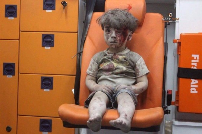 „Scanpix“ nuotr./Sužeistas penkiametis Alepe