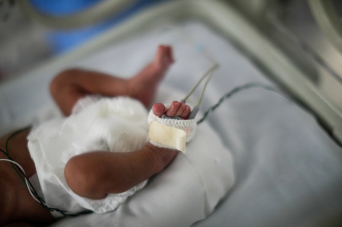 „Reuters“/„Scanpix“ nuotr./COVID-19 sergantis kūdikis Meksikoje
